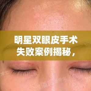 明星双眼皮手术失败案例揭秘，美丽手术的风险与警示