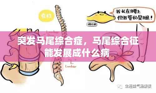 突发马尾综合症,马尾综合征能发展成什么病